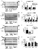 Oligomer A11 Antibody in Western Blot (WB)