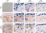 CD68 Antibody in Immunohistochemistry (IHC)