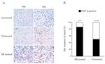 CD117 (c-Kit) Antibody in Immunohistochemistry (IHC)