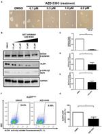 beta Catenin Antibody in Western Blot (WB)