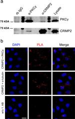 PKC gamma Antibody in Proximity Ligation Assay (PLA) (PLA)