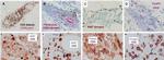 FOXP3 Antibody in Immunohistochemistry (IHC)