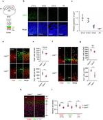 EOMES Antibody in Immunohistochemistry (IHC)