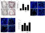 VCAM-1 Antibody in Immunohistochemistry (IHC)