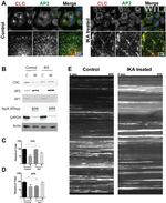 alpha Adaptin Antibody in Immunocytochemistry (ICC/IF)