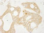 vPARP Antibody in Immunohistochemistry (IHC)