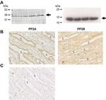 Phospho-Aquaporin 2 (Ser264) Antibody in Western Blot (WB)