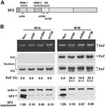 SRSF1 Antibody in Western Blot (WB)