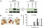 Glucocorticoid Receptor beta Antibody in Western Blot (WB)