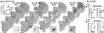 beta Amyloid (1-42) Antibody in Immunohistochemistry (IHC)