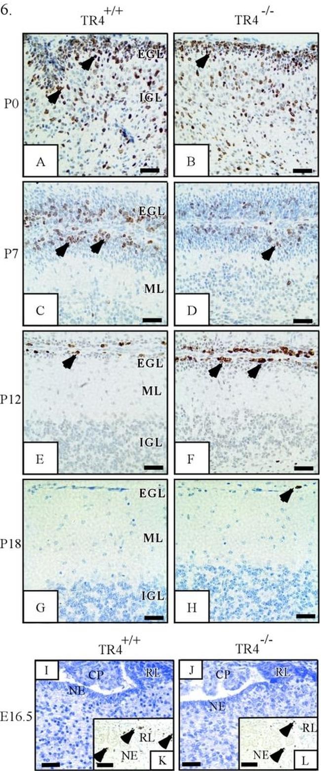 BrdU Antibody in Immunohistochemistry (IHC)