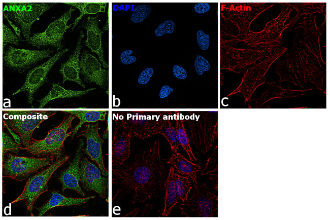 Annexin A2 Antibody in Immunocytochemistry (ICC/IF)