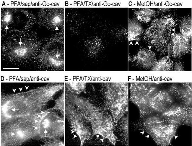 Caveolin 1 Antibody in Immunocytochemistry (ICC/IF)