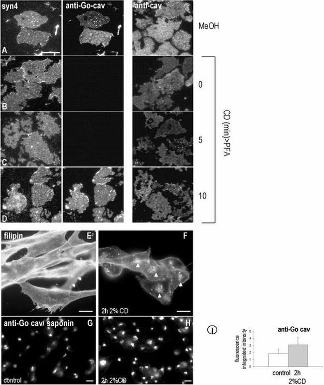 Caveolin 1 Antibody in Immunocytochemistry (ICC/IF)