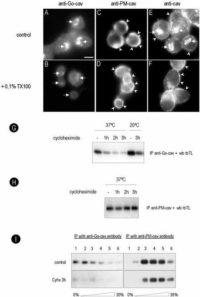 Caveolin 1 Antibody in Western Blot, Immunocytochemistry, Immunoprecipitation (WB, ICC/IF, IP)