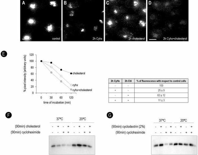 Caveolin 1 Antibody in Western Blot, Immunocytochemistry, Immunoprecipitation (WB, ICC/IF, IP)