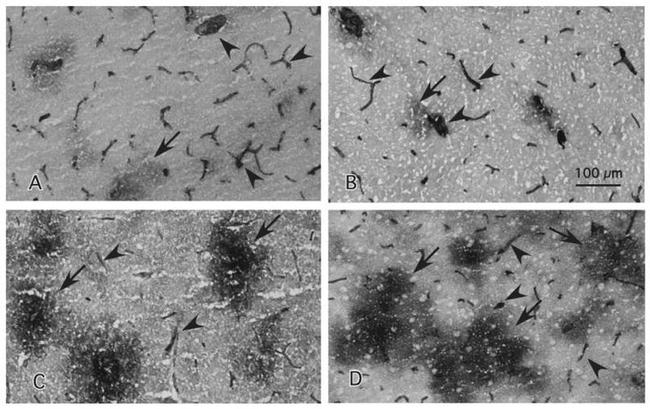 ICAM-1 Antibody in Immunohistochemistry (IHC)