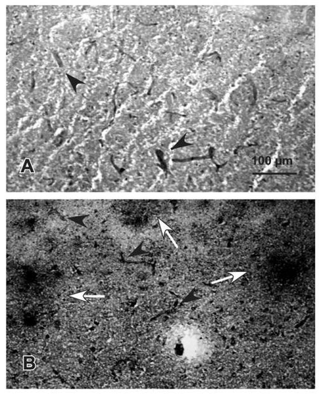 ICAM-1 Antibody in Immunohistochemistry (IHC)