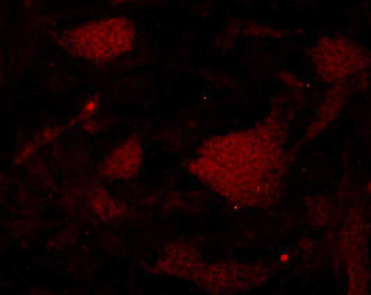 Albumin Antibody in Immunocytochemistry (ICC/IF)