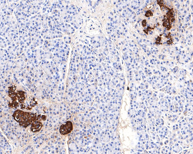 Insulin B Chain Antibody in Immunohistochemistry (Paraffin) (IHC (P))