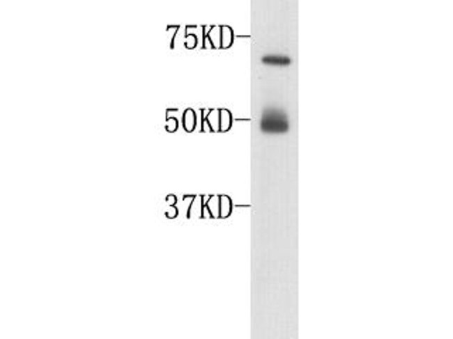 Complement C3 (beta chain) Antibody in Western Blot (WB)
