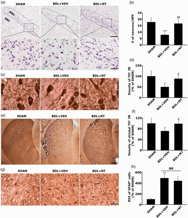 GFAP Antibody in Immunohistochemistry (IHC)