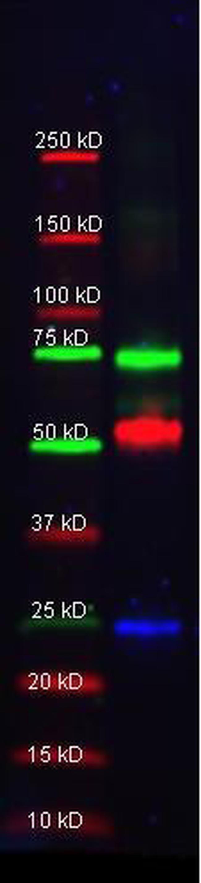 alpha-1-Anti-Trypsin Antibody in Western Blot (WB)