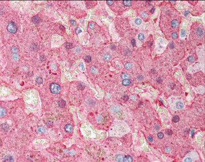 Fibrinogen Antibody in Immunohistochemistry (Paraffin) (IHC (P))