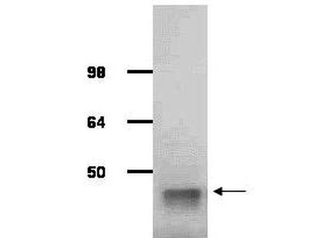 Aldolase Antibody in Western Blot (WB)