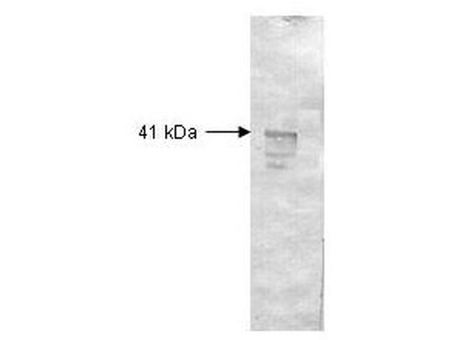 Dextranase Antibody in Western Blot (WB)