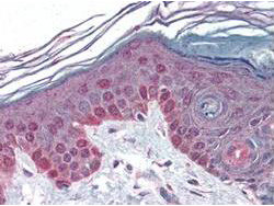 Cyclin T1 Antibody in Immunohistochemistry (Paraffin) (IHC (P))