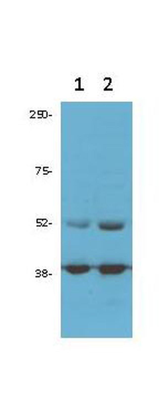 CDK9 Antibody in Western Blot (WB)