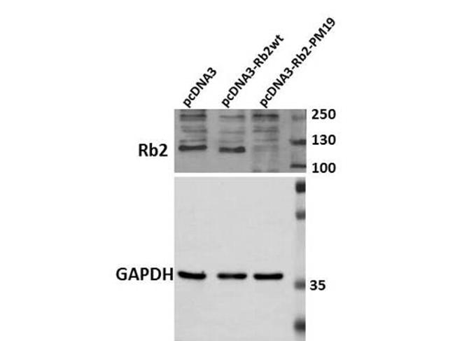 p130 Rb2 Antibody in Western Blot (WB)