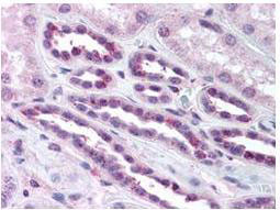 Phospho-NFkB (RelA) (Ser276) Antibody in Immunohistochemistry (Paraffin) (IHC (P))