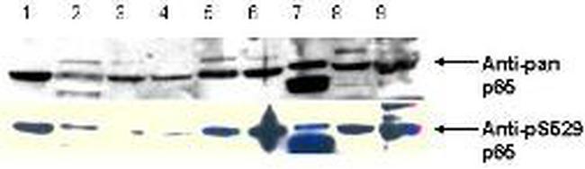 Phospho-NFkB (RelA) (Ser276) Antibody in Western Blot (WB)