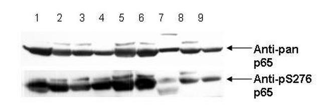 Phospho-NFkB (RelA) (Ser276) Antibody in Western Blot (WB)