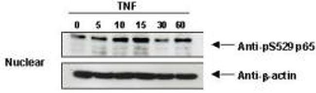 Phospho-NFkB (RelA) (Ser276) Antibody in Western Blot (WB)