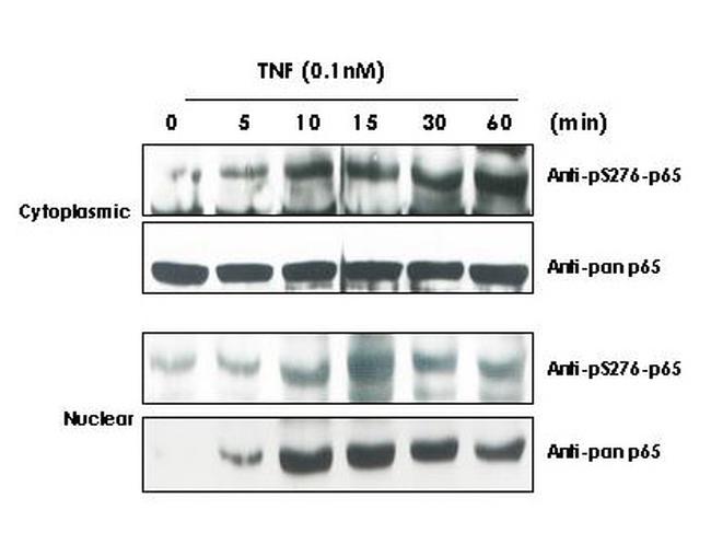 Phospho-NFkB (RelA) (Ser276) Antibody in Western Blot (WB)