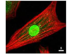 AKT Antibody in Immunocytochemistry (ICC/IF)