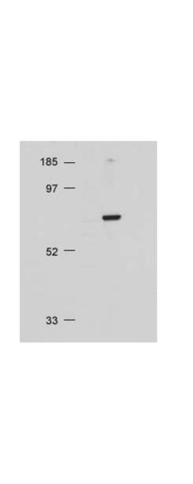 AKT Antibody in Western Blot (WB)