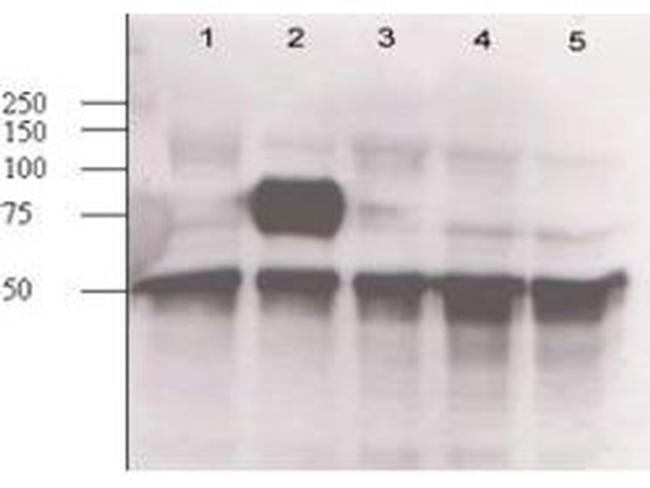 Angiopoietin 2 Antibody in Western Blot (WB)