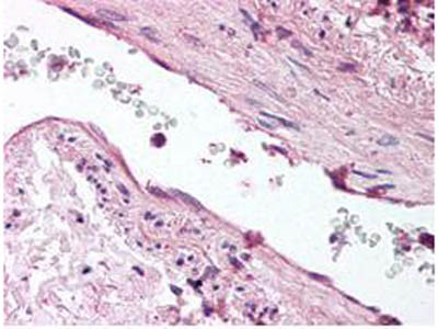 Angiopoietin 1 Antibody in Immunohistochemistry (Paraffin) (IHC (P))