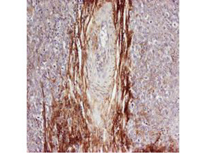 Osteopontin Antibody in Immunohistochemistry (IHC)