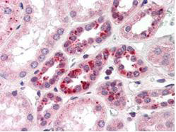 NOTCH 2 Antibody in Immunohistochemistry (Paraffin) (IHC (P))