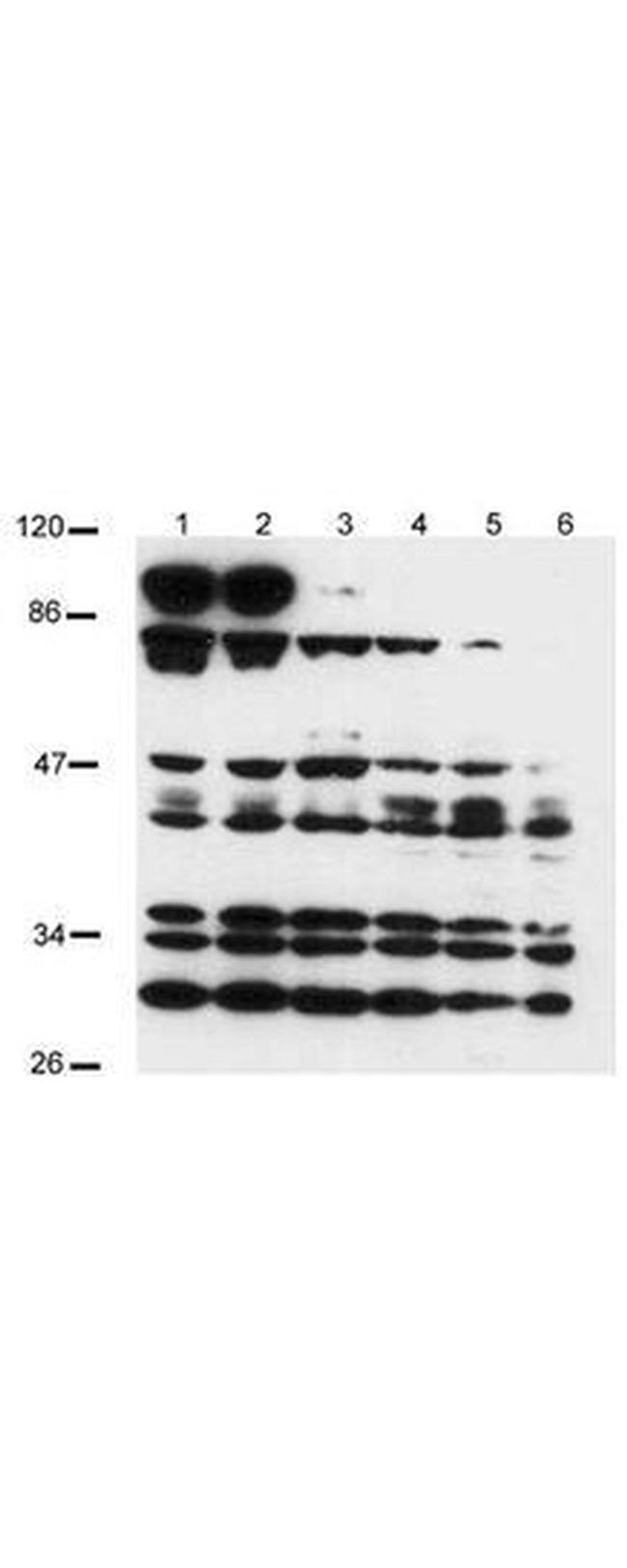 NOTCH 2 Antibody in Western Blot (WB)