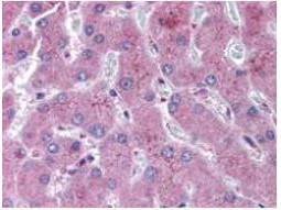 NOTCH 2 Antibody in Immunohistochemistry (Paraffin) (IHC (P))