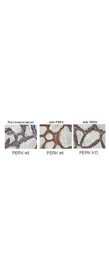 PERK Antibody in Immunohistochemistry (IHC)