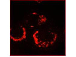 Sars-Cov Nonstructural Protein 13 Antibody in Immunocytochemistry (ICC/IF)