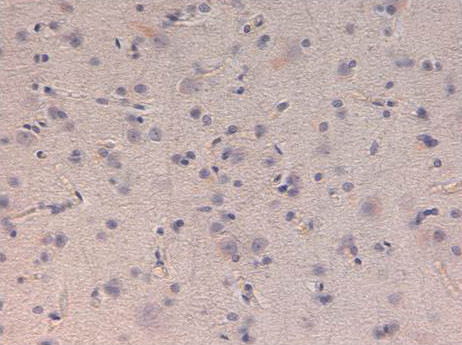 Kinesin-1 Antibody in Immunohistochemistry (IHC)