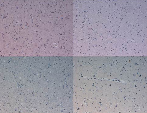 Kinesin-1 Antibody in Immunohistochemistry (IHC)